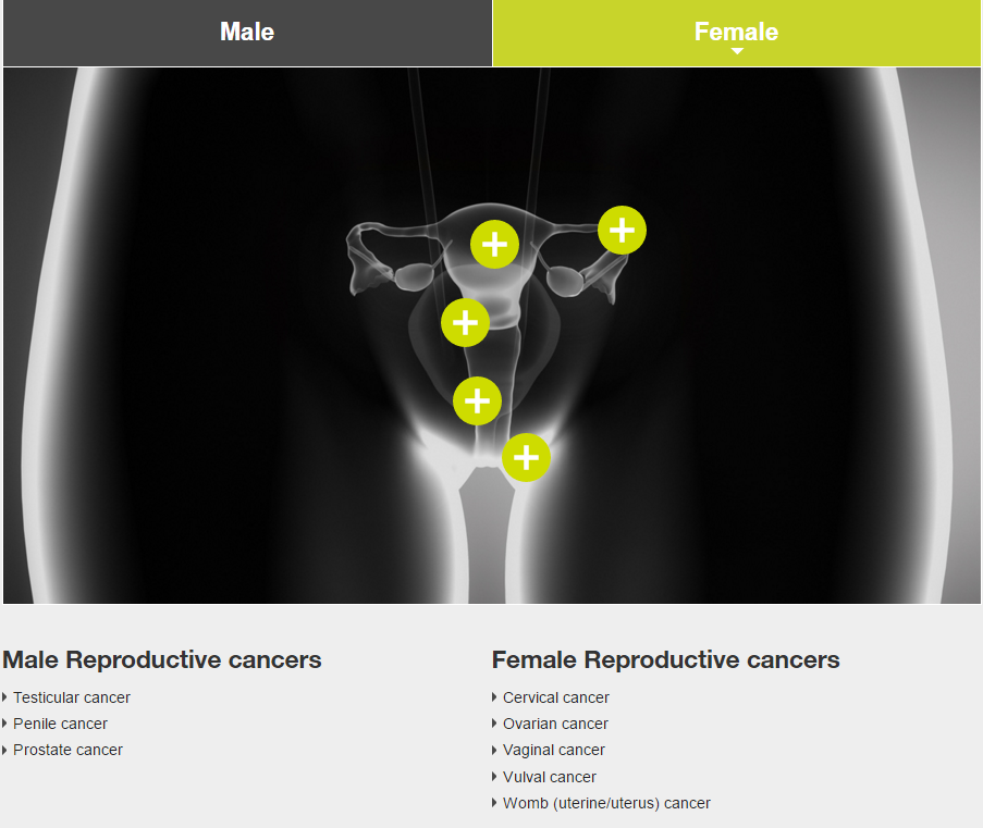Female reproductive cancer image