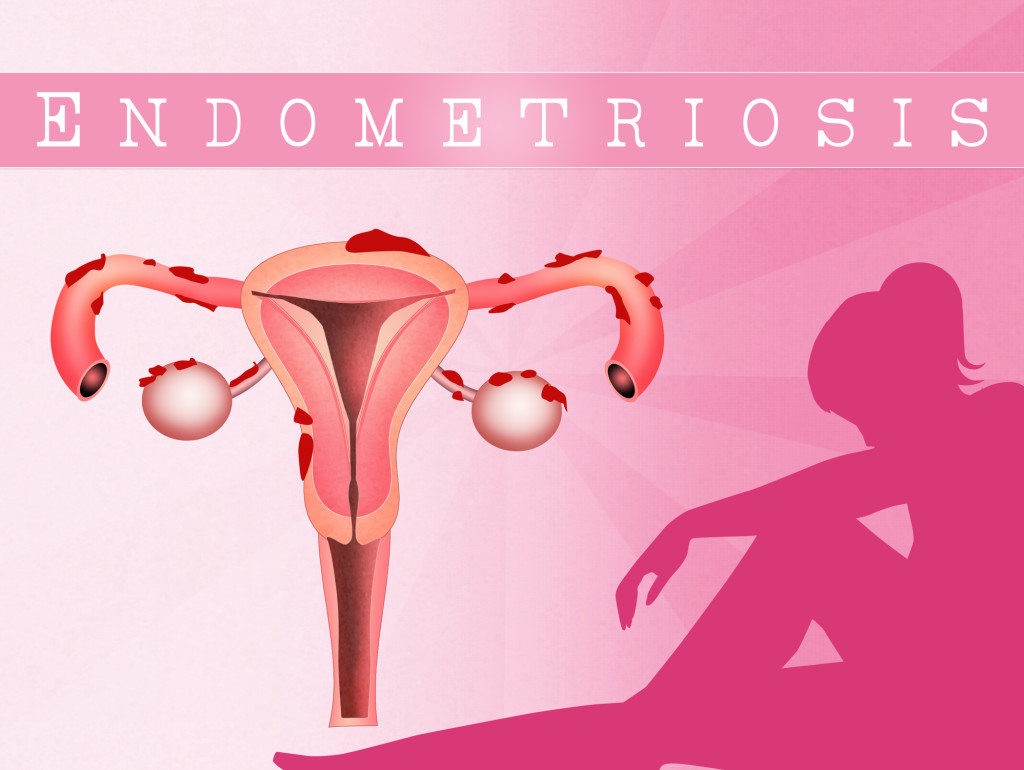 pregnancy does not cure endometriosis and made mine come back worse than before